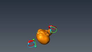 Epley Maneuver for BPPVertigo  Auburn Medical Group [upl. by Eleph]