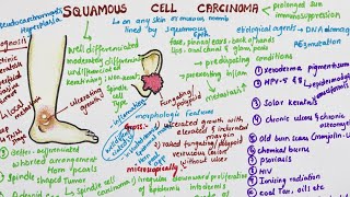 Squamous Cell Carcinoma  Pathology [upl. by Fabio]