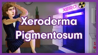 Xeroderma Pigmentosum Mnemonic for USMLE [upl. by Aloivaf759]