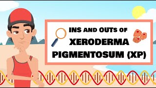 The Ins and Outs of XP Xeroderma pigmentosum [upl. by Benis]