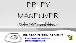 EPLEY MANEUVER RIGHT PSC [upl. by Polad489]